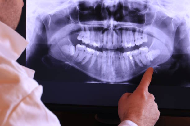 Best Emergency Tooth Extraction in New Waverly, TX